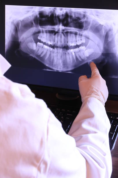 Best Walk-In Emergency Dentist in Shingle Springs, CA